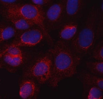 Nitric Oxide Synthase 3 Antibody / NOS3 / eNOS