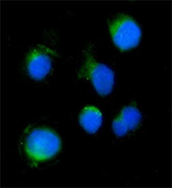 Aigp1 Antibody / Serinc3