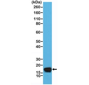 STMN1 Antibody / Stathmin