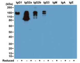 IgG Heavy Chain Antibody