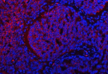 TRMT2B Antibody / tRNA (uracil-5-)-methyltransferase homolog B