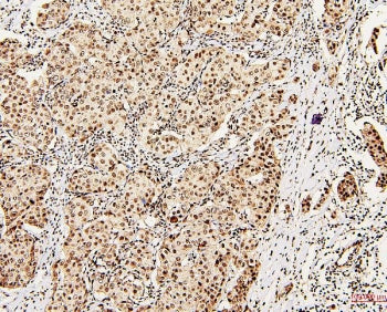 DDX5 Antibody