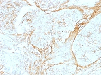 Tenascin C Antibody