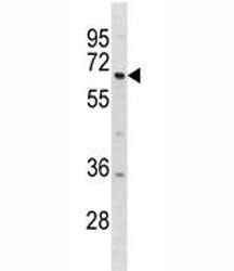 DYRK1B antibody western blot analysis in 293 lysate. Predicted molecular weight: 69/75 kDa (isoforms