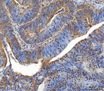 TTLL12 Antibody / Tubulin Tyrosine Ligase Like 12