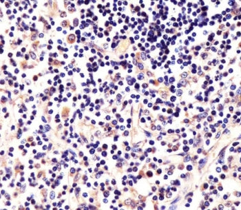 LCK Antibody