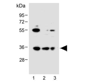 BCKDHB Antibody