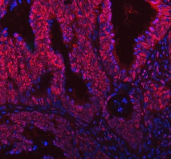 SNRNP200 Antibody / U5 snRNP-specific 200 kDa protein