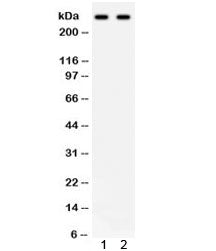 Western blot testing of 1) human HeLa and 2) SW620 lysate with ITPR3 antibody. Predicted molecular w