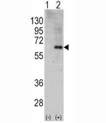 AMPK alpha 2 Antibody (PRKAA2)