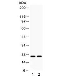 HSPB2 Antibody