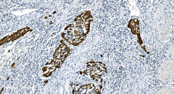 Glycine Decarboxylase Antibody / GLDC