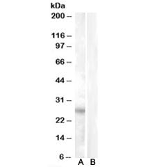 RASSF3 Antibody
