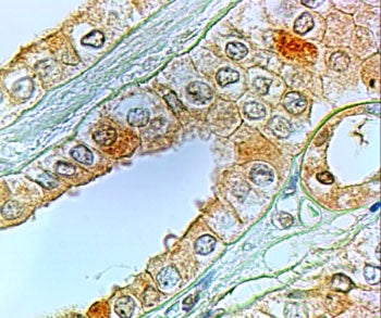 PTGER1 Antibody