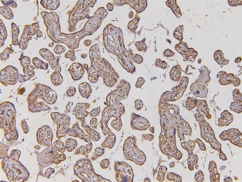 IHC staining of FFPE human placenta with EHD1 antibody. HIER: boil tissue sections in pH6, 10mM citr