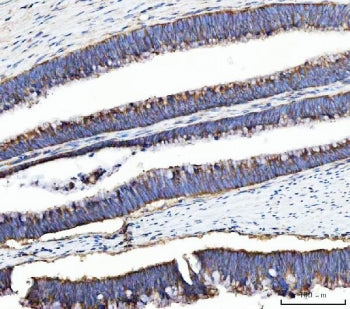 UBA5 Antibody / Ubiquitin-activating enzyme 5