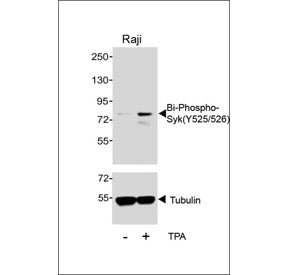 Western blot testing of lysate from human Raji cells that was untreated (-) and treated with 200 nm
