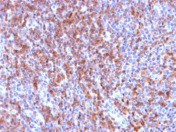 IHC staining of FFPE human tonsil tissue with recombinant ICAM3 antibody (clone ICAM3/2873R). HIER: