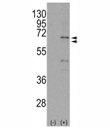 NUR77 Antibody (NR4A1)
