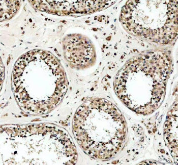 IHC staining of FFPE human testis tissue with USP5 antibody, HRP-secondary and DAB substrate. HIER: