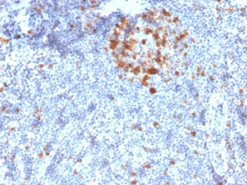 IHC staining of FFPE human tonsil with CDC2 antibody (clone A17.1.1). HIER: boil tissue sections in