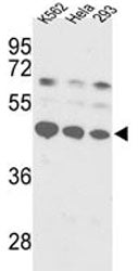 SSB Antibody