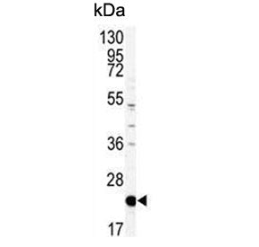 PEBP1 Antibody / PBP / RKIP