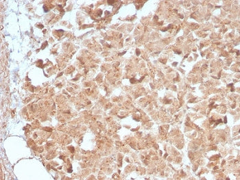 IHC testing of human pancreas with recombinant CELA3B antibody (clone CELA3B/2809R). Required HIER: