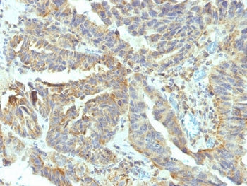 Tissue-nonspecific Alkaline Phosphatase Antibody / ALPL