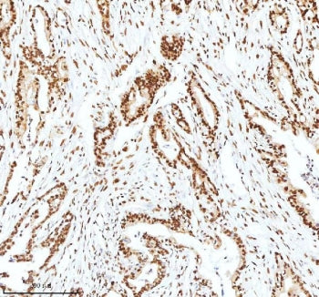 Ku70 Antibody / XRCC6
