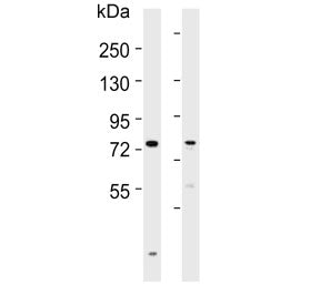 SLCO1B3 Antibody