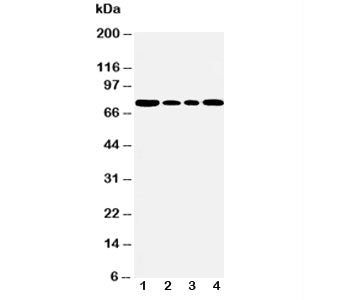 Western blot testing of BiP antibody and Lane 1: rat testis; 2: A549; 3: MCF-7; 4: HeLa cell lysate.