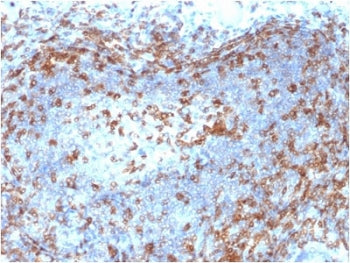 ZAP70 Antibody