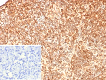 IHC staining of FFPE human lymph node tissue with Calbindin D9K antibody (clone S100G/7517). Inset: