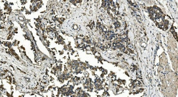 Folliculin Antibody / FLCN