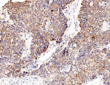 RPL8 Antibody / Ribosomal Protein L8