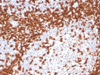 IHC staining of FFPE human tonsil tissue with CD45RA antibody (clone T200/8144R). HIER: boil tissue