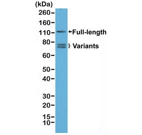 Androgen Receptor Antibody (N-Terminal)