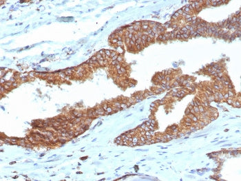 IHC staining of FFPE human prostate tissue with Cyclooxygenase 2 antibody (clone COX2/7803R). HIER: