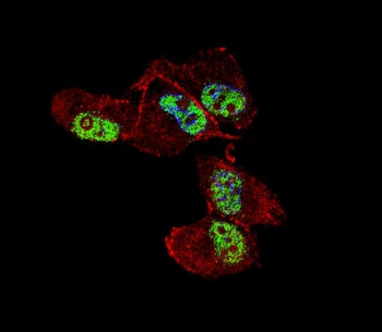 ZNF202 Antibody