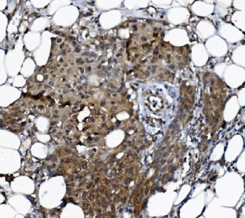 DCTN1 Antibody / p150-glued / Dynactin