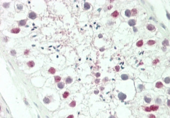 HOXA3 Antibody