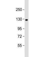 ACK1 Antibody / Activated CDC42 kinase 1