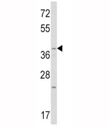 WNT1 Antibody