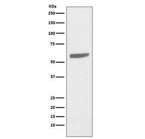 Cytokeratin 5 Antibody / KRT5