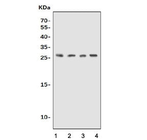 UPK1B Antibody / Uroplakin 1B