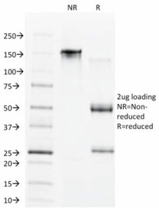CDX1 Antibody / Caudal Type Homeobox 1
