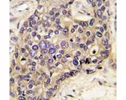 Hepatocyte Growth Factor Antibody (HGF)