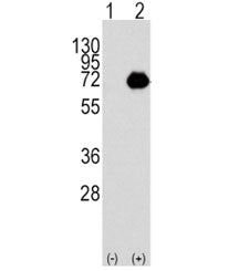 ACOX1 Antibody / Peroxisomal acyl-coenzyme A oxidase 1