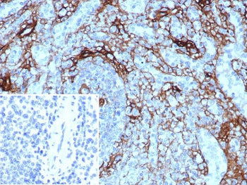 IHC staining of FFPE human spleen tissue with CD271 antibody (clone NGFR/8590R). Inset: PBS used in
